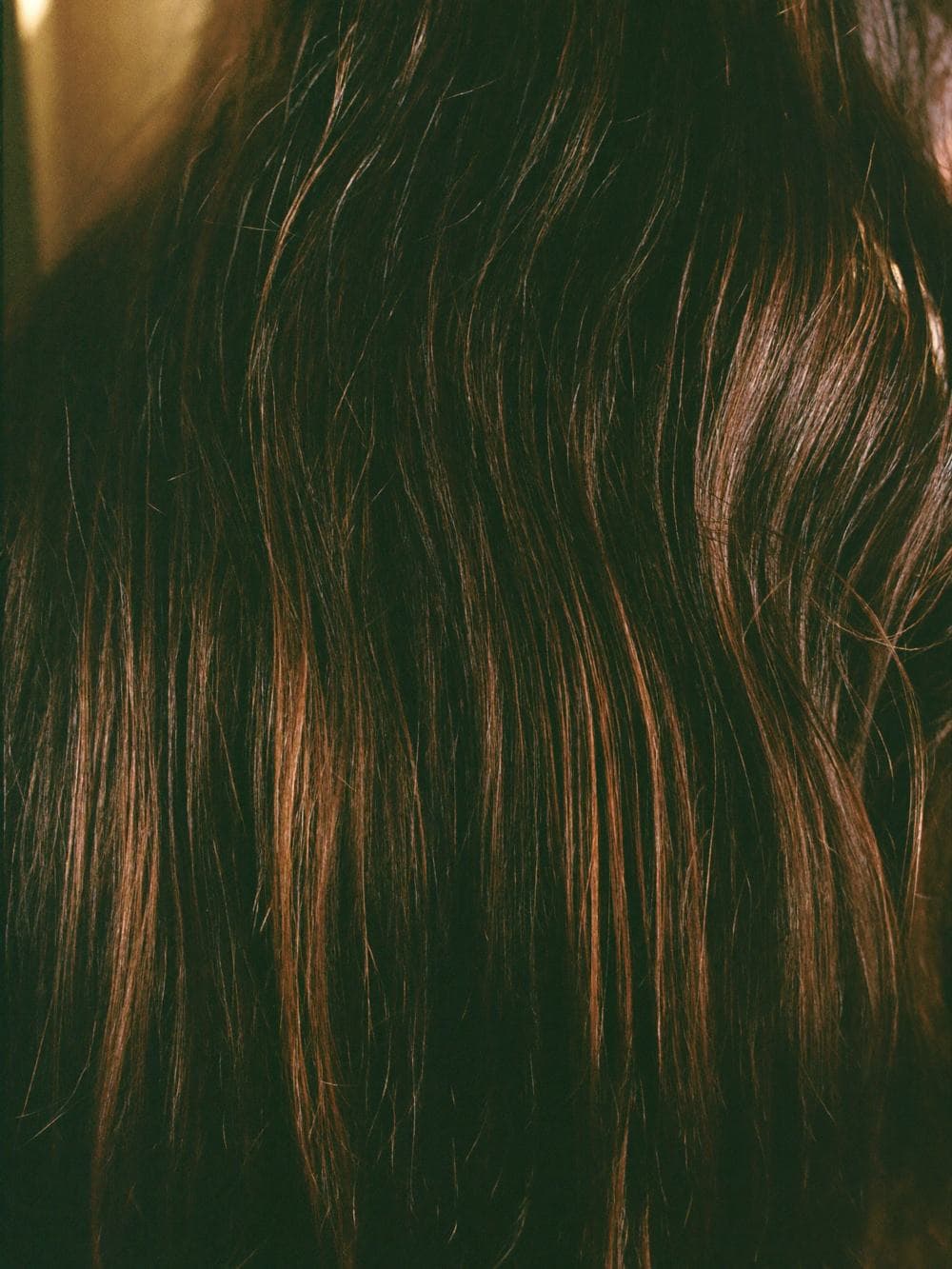 Hair Transplant in India